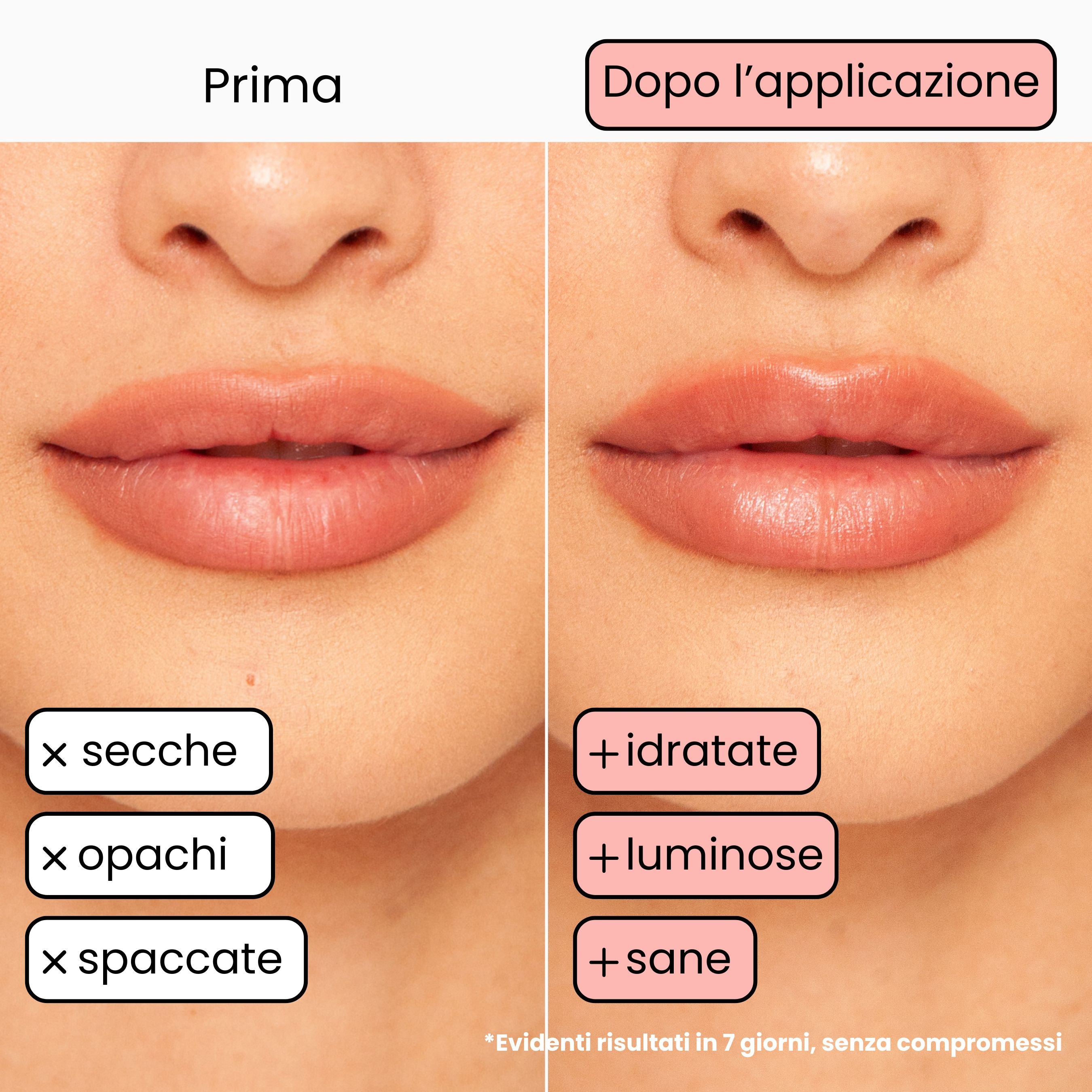 Balsamo Labbra Anguria