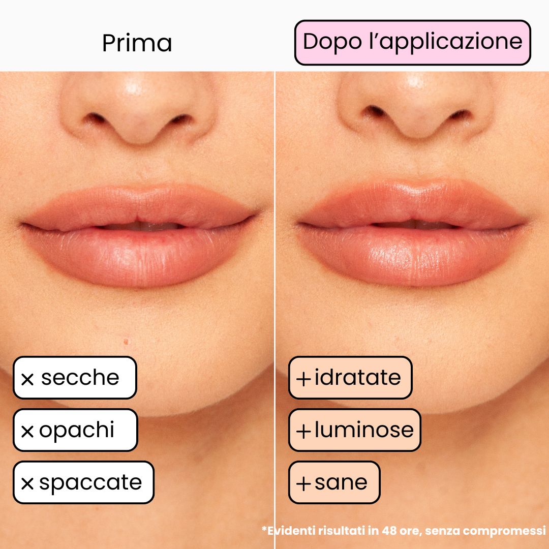 Balsamo Labbra BERRY - Mora e Mirtillo