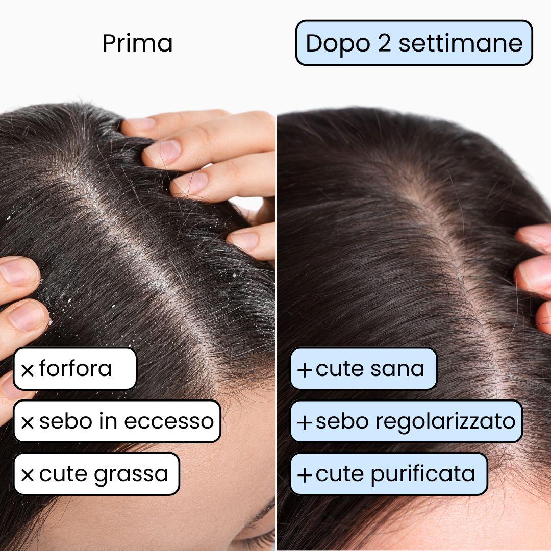 Shampoo Solido Purificante x2 per capelli Grassi