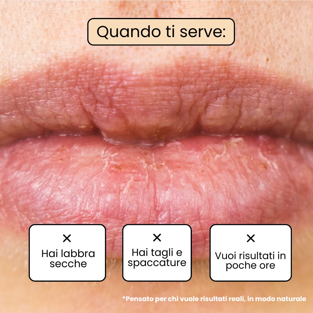 Balsamo Labbra CHOCO - Cioccolato