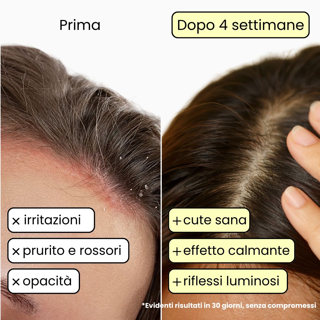 Shampoo Solido Lenitivo x2 per cuti Sensibili